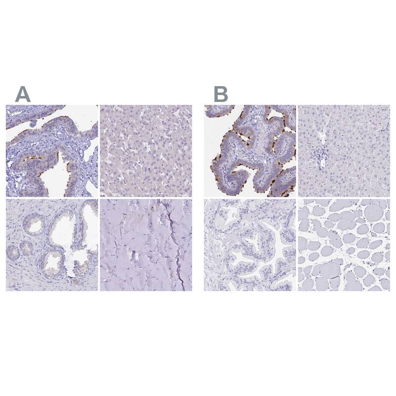 Sentan Antibody - BSA Free Immunohistochemistry: Sentan Antibody - BSA Free [NBP1-92378]