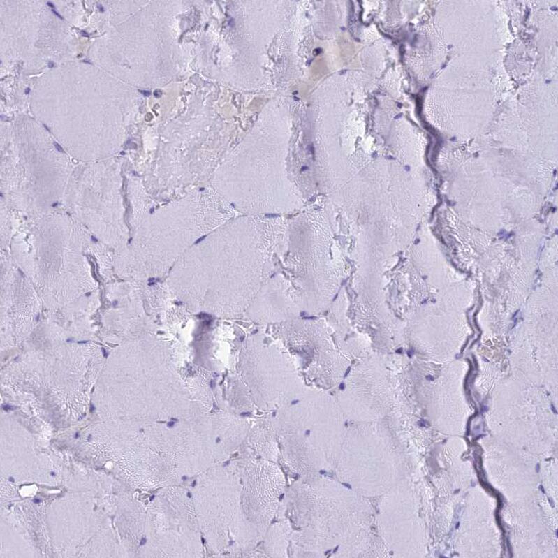 Sentan Antibody - BSA Free Immunohistochemistry: Sentan Antibody - BSA Free [NBP1-92378]