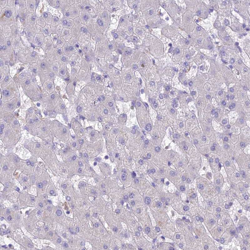 Sentan Antibody - BSA Free Immunohistochemistry: Sentan Antibody - BSA Free [NBP1-92378]