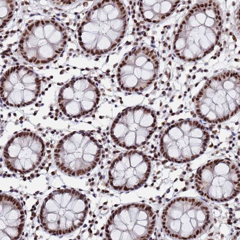 SF3B2 Antibody - BSA Free Immunohistochemistry: SF3B2 Antibody - BSA Free [NBP1-92380]