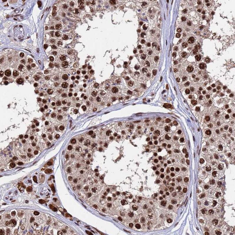 SF3B2 Antibody - BSA Free Immunohistochemistry: SF3B2 Antibody - BSA Free [NBP1-92380]