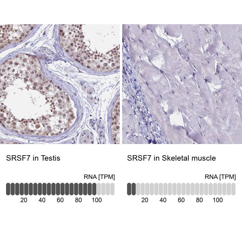 SFRS7 Antibody - BSA Free Immunohistochemistry: SFRS7 Antibody - BSA Free [NBP1-92382]