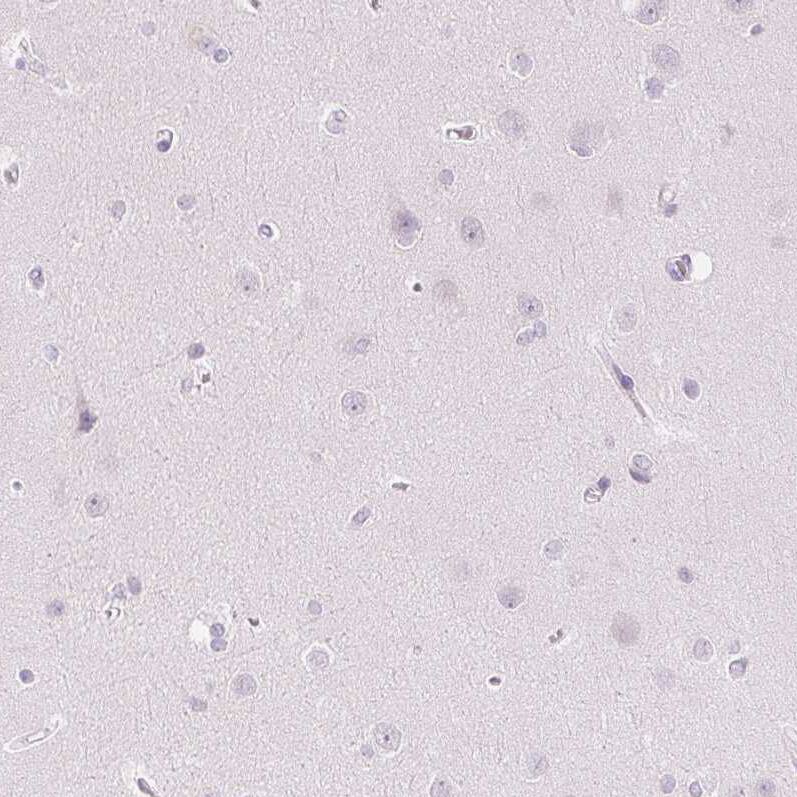 SGLT2/SLC5A2 Antibody - BSA Free Immunohistochemistry: SGLT2/SLC5A2 Antibody - BSA Free [NBP1-92384]