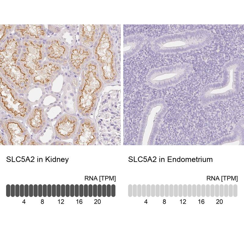 SGLT2/SLC5A2 Antibody - BSA Free Immunohistochemistry: SGLT2/SLC5A2 Antibody - BSA Free [NBP1-92384]