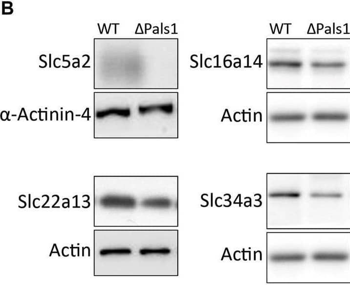 SGLT2/SLC5A2 Antibody - BSA Free