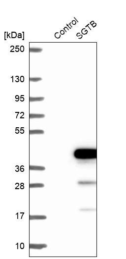 SGTB Antibody - BSA Free Western Blot: SGTB Antibody - BSA Free [NBP1-92385]