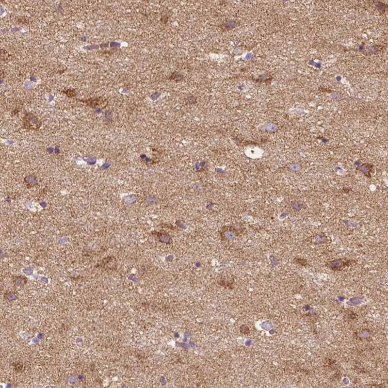 SGTB Antibody - BSA Free Immunohistochemistry: SGTB Antibody - BSA Free [NBP1-92385]
