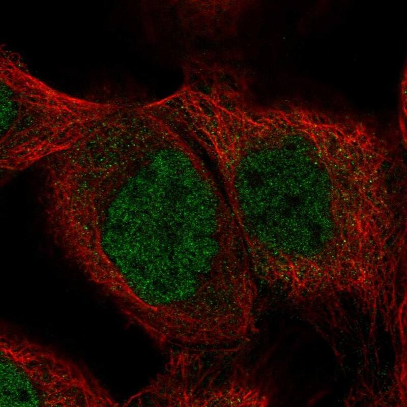 SHQ1 Antibody - BSA Free Immunocytochemistry/ Immunofluorescence: SHQ1 Antibody - BSA Free [NBP1-92388]