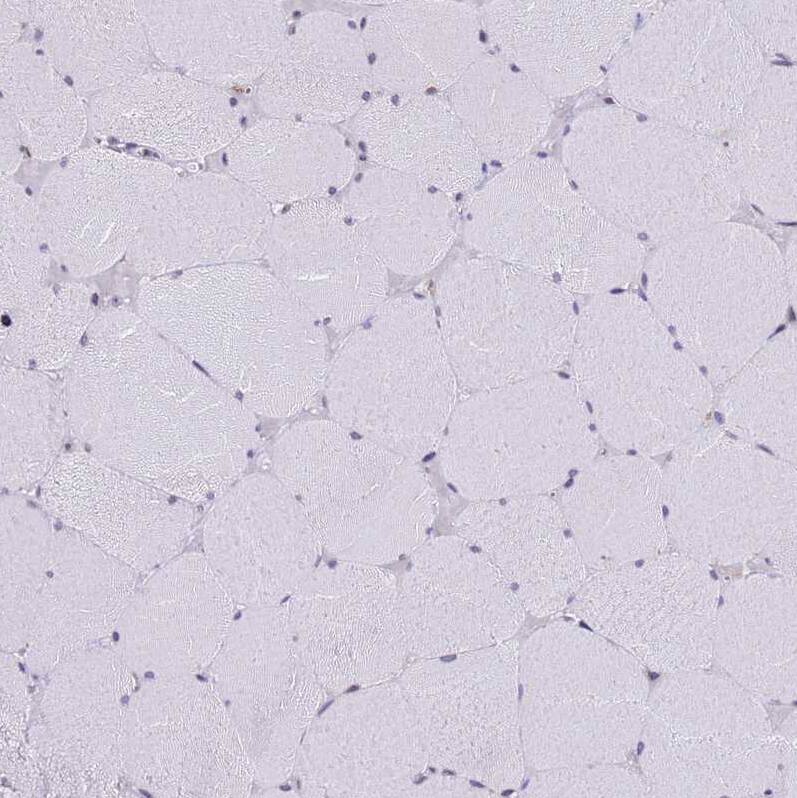 Signal sequence receptor delta Antibody - BSA Free Immunohistochemistry: Signal sequence receptor delta Antibody - BSA Free [NBP1-92390]