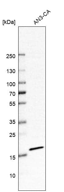 Signal sequence receptor delta Antibody - BSA Free Western Blot: Signal sequence receptor delta Antibody - BSA Free [NBP1-92390]