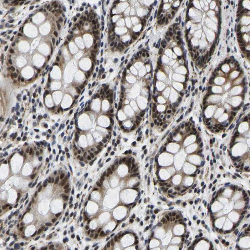 SKAR Antibody - BSA Free Immunohistochemistry: SKAR Antibody - BSA Free [NBP1-92392]