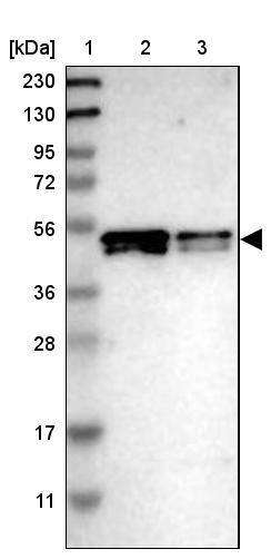 SKAR Antibody - BSA Free Western Blot: SKAR Antibody - BSA Free [NBP1-92392]