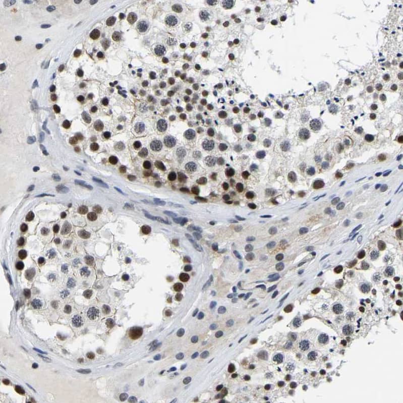 SKAR Antibody - BSA Free Immunohistochemistry: SKAR Antibody - BSA Free [NBP1-92392]