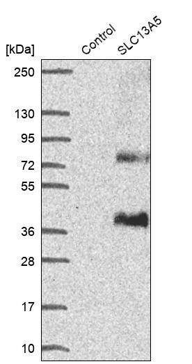 SLC13A5 Antibody - BSA Free Western Blot: SLC13A5 Antibody - BSA Free [NBP1-92394]