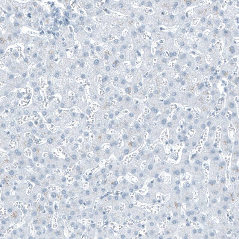 SLC22A8 Antibody - BSA Free Immunohistochemistry: SLC22A8 Antibody - BSA Free [NBP1-92396]