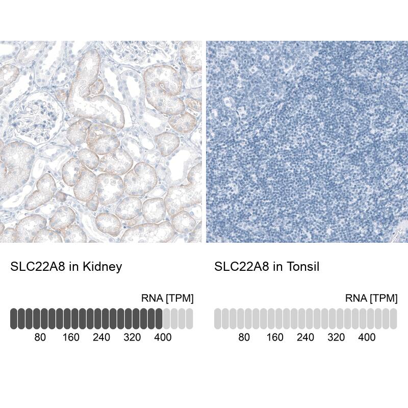 SLC22A8 Antibody - BSA Free Immunohistochemistry: SLC22A8 Antibody - BSA Free [NBP1-92396]