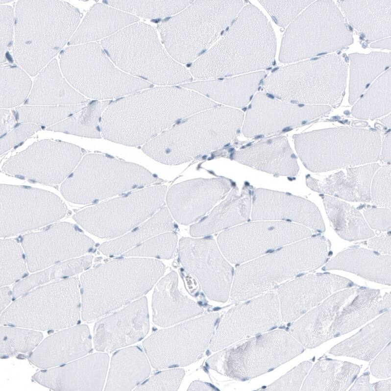 SLC22A8 Antibody - BSA Free Immunohistochemistry: SLC22A8 Antibody - BSA Free [NBP1-92396]