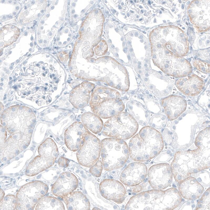 SLC22A8 Antibody - BSA Free Immunohistochemistry: SLC22A8 Antibody - BSA Free [NBP1-92396]