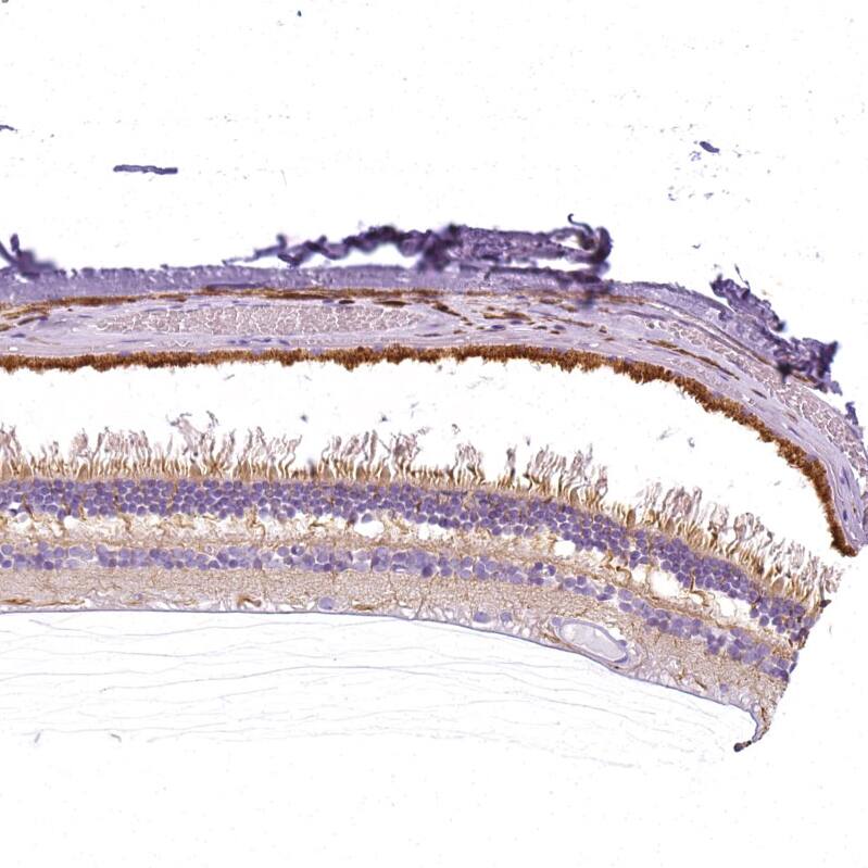 SLC24A1 Antibody - BSA Free Immunohistochemistry: SLC24A1 Antibody - BSA Free [NBP1-92397]