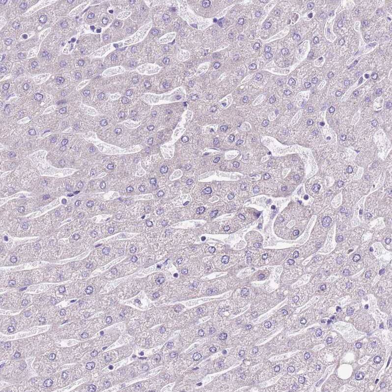 SLC38A5 Antibody - BSA Free Immunohistochemistry: SLC38A5 Antibody - BSA Free [NBP1-92402]