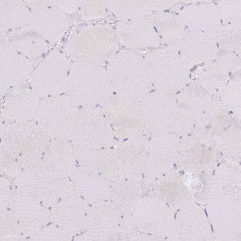 SLC38A5 Antibody - BSA Free Immunohistochemistry: SLC38A5 Antibody - BSA Free [NBP1-92402]