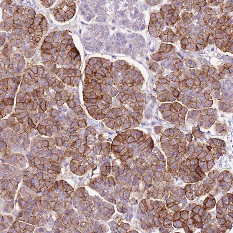 SLC38A5 Antibody - BSA Free Immunohistochemistry: SLC38A5 Antibody - BSA Free [NBP1-92402]