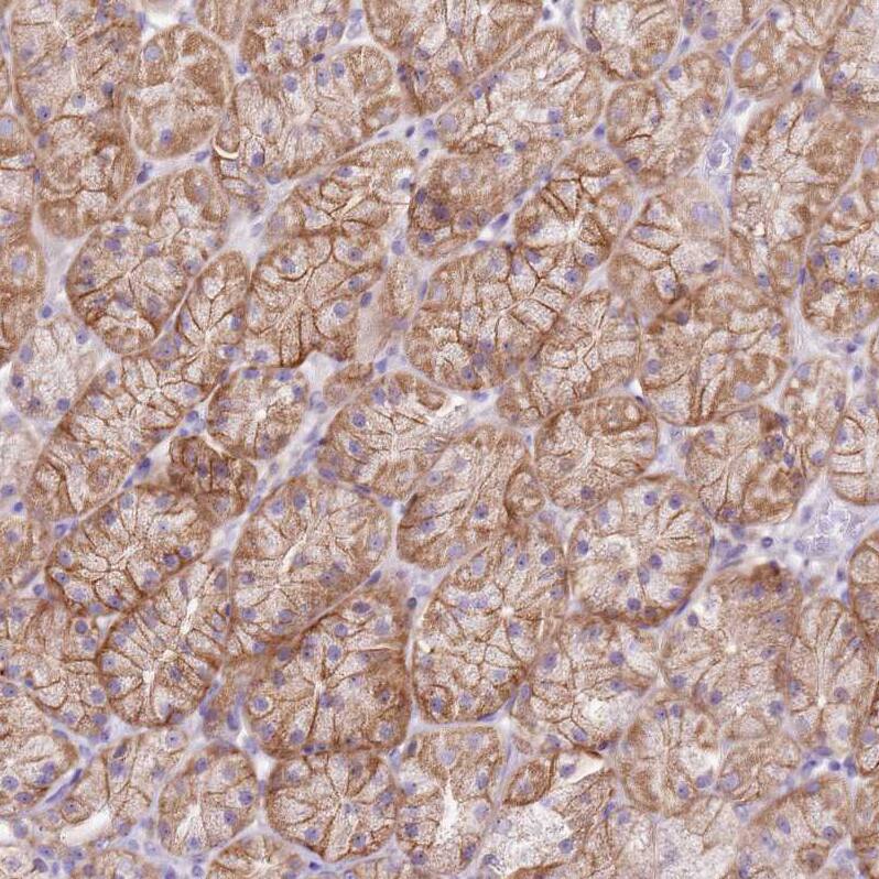 SLC38A5 Antibody - BSA Free Immunohistochemistry: SLC38A5 Antibody - BSA Free [NBP1-92402]