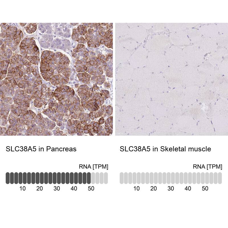 SLC38A5 Antibody - BSA Free Immunohistochemistry: SLC38A5 Antibody - BSA Free [NBP1-92402]
