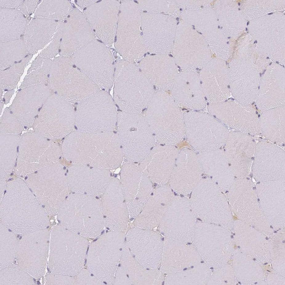 SLC38A9 Antibody - BSA Free Immunohistochemistry: SLC38A9 Antibody - BSA Free [NBP1-92403]