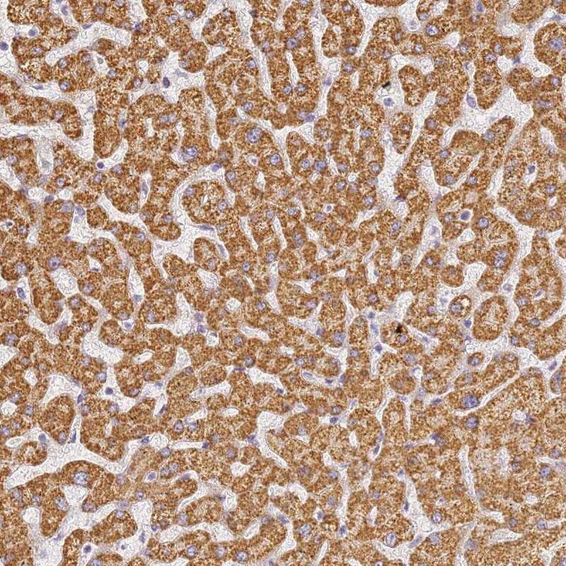 SLC38A9 Antibody - BSA Free Immunohistochemistry: SLC38A9 Antibody - BSA Free [NBP1-92403]