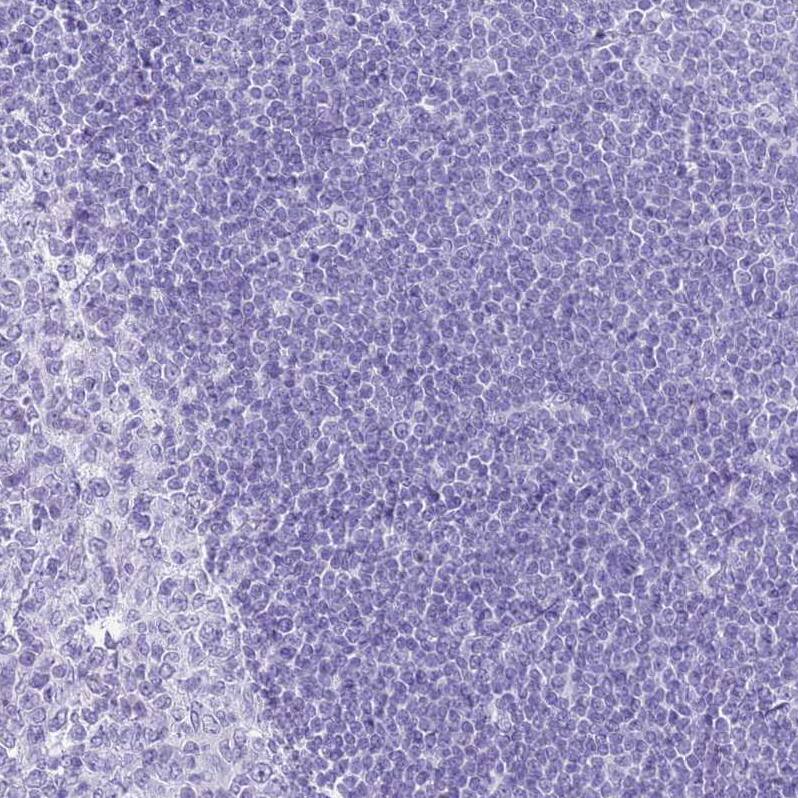 SLC7A9 Antibody - BSA Free Immunohistochemistry: SLC7A9 Antibody - BSA Free [NBP1-92409]
