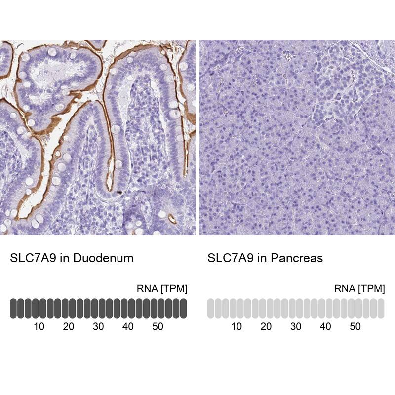 SLC7A9 Antibody - BSA Free Immunohistochemistry: SLC7A9 Antibody - BSA Free [NBP1-92409]