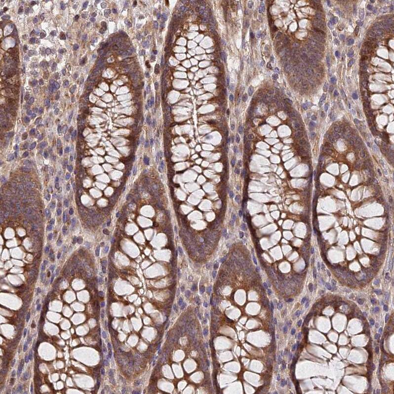 SMG6 Antibody - BSA Free Immunohistochemistry: SMG6 Antibody - BSA Free [NBP1-92410]