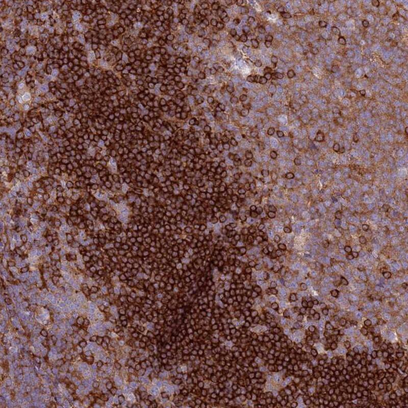 SNX21 Antibody - BSA Free Immunohistochemistry: SNX21 Antibody - BSA Free [NBP1-92419]