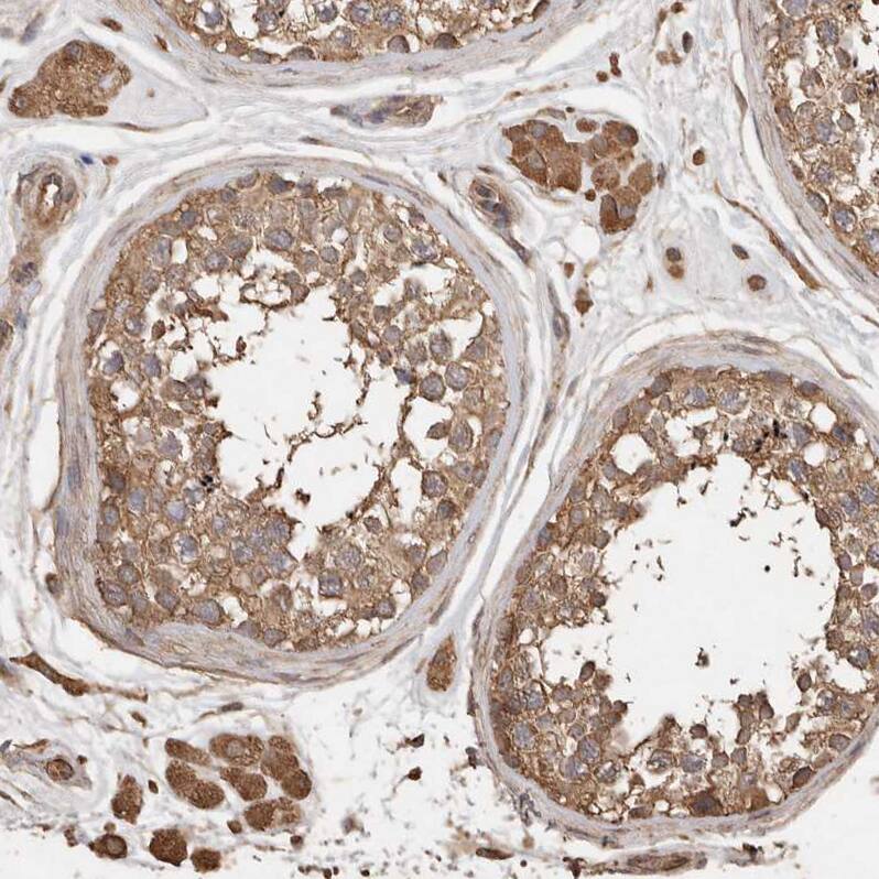Sorting Nexin 31 Antibody - BSA Free Immunohistochemistry: Sorting Nexin 31 Antibody - BSA Free [NBP1-92423]