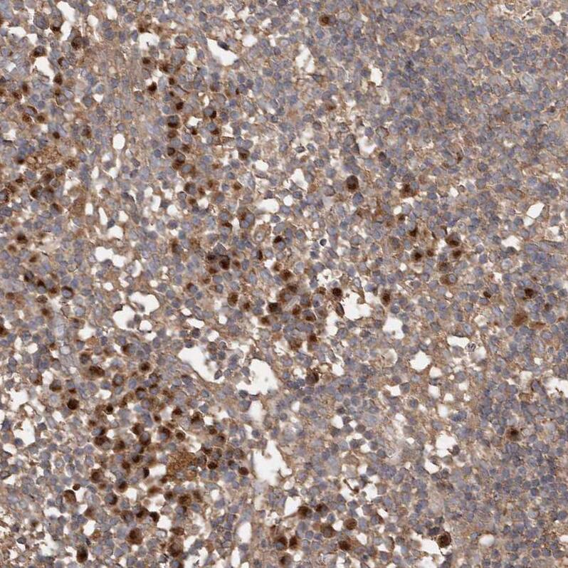Sorting Nexin 31 Antibody - BSA Free Immunohistochemistry: Sorting Nexin 31 Antibody - BSA Free [NBP1-92423]