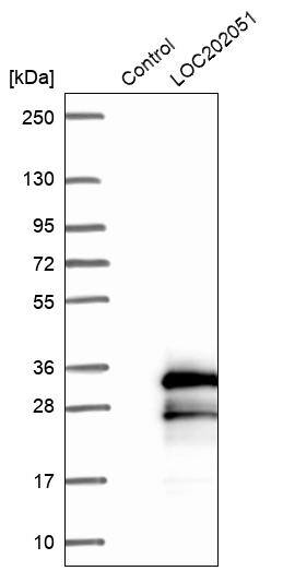SPATA24 Antibody - BSA Free Western Blot: SPATA24 Antibody - BSA Free [NBP1-92429]