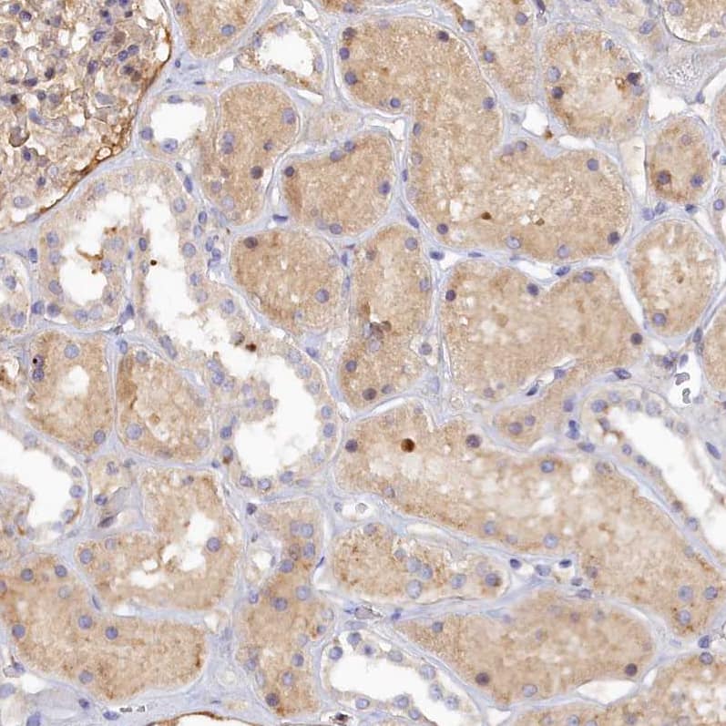 SPATA5L1 Antibody - BSA Free Immunohistochemistry: SPATA5L1 Antibody - BSA Free [NBP1-92430]