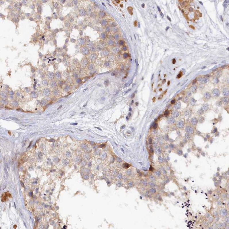 SPATA5L1 Antibody - BSA Free Immunohistochemistry: SPATA5L1 Antibody - BSA Free [NBP1-92430]