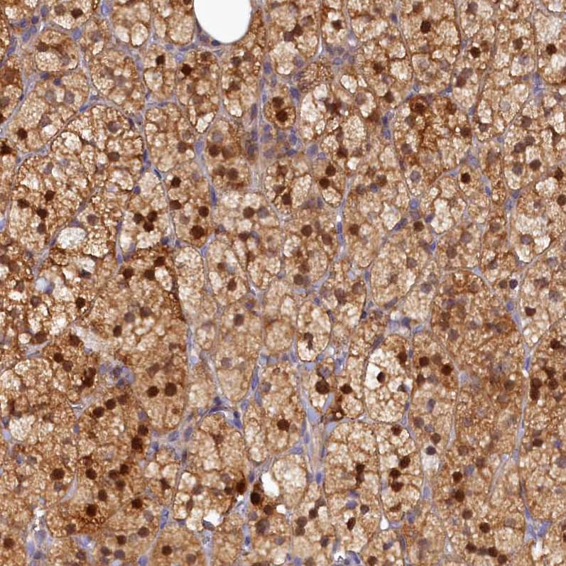SPATA5L1 Antibody - BSA Free Immunohistochemistry: SPATA5L1 Antibody - BSA Free [NBP1-92430]