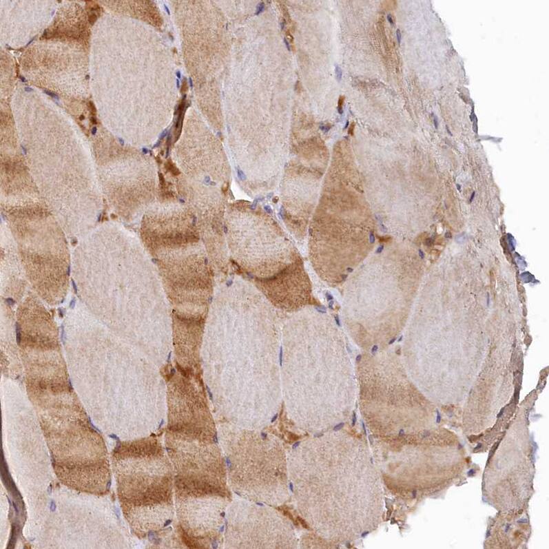 SPATA5L1 Antibody - BSA Free Immunohistochemistry: SPATA5L1 Antibody - BSA Free [NBP1-92430]