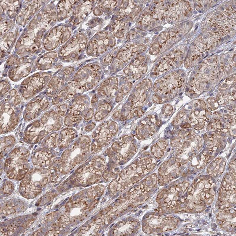 Sphingomyelin synthase 1 Antibody - BSA Free Immunohistochemistry: Sphingomyelin synthase 1 Antibody - BSA Free [NBP1-92435]