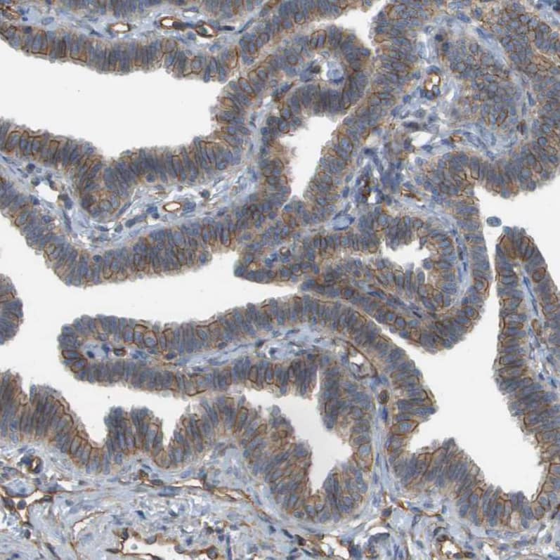 Sphingomyelin Synthase 2 Antibody - BSA Free Immunohistochemistry: Sphingomyelin Synthase 2 Antibody - BSA Free [NBP1-92436]