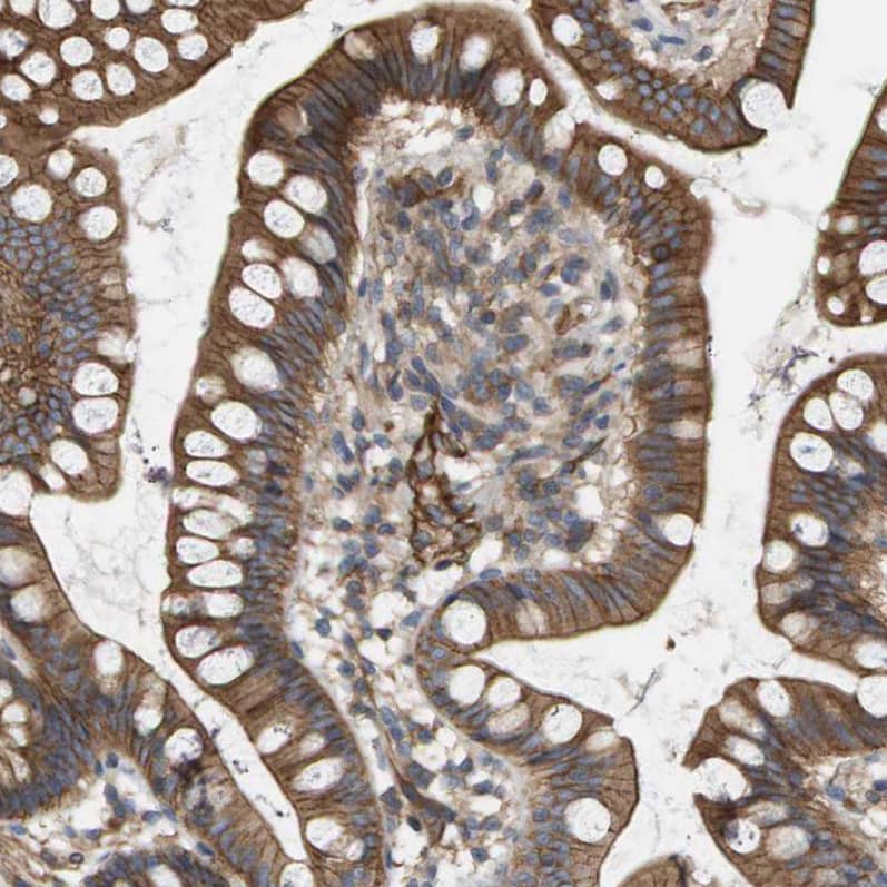 Sphingomyelin Synthase 2 Antibody - BSA Free Immunohistochemistry: Sphingomyelin Synthase 2 Antibody - BSA Free [NBP1-92436]