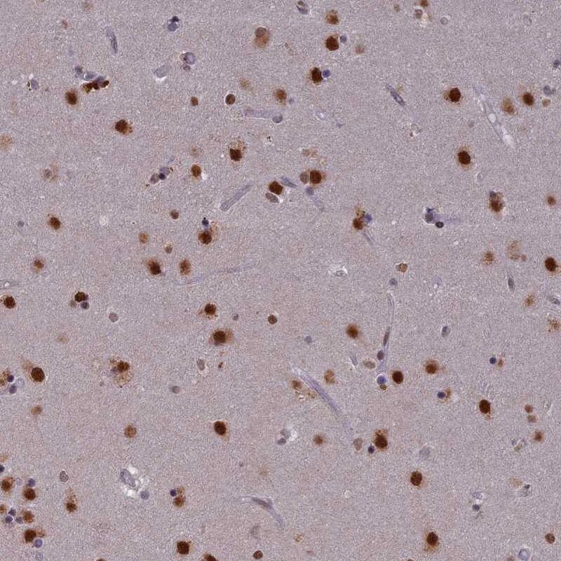 SPIRE1 Antibody - BSA Free Immunohistochemistry-Paraffin: SPIRE1 Antibody [NBP1-92438]