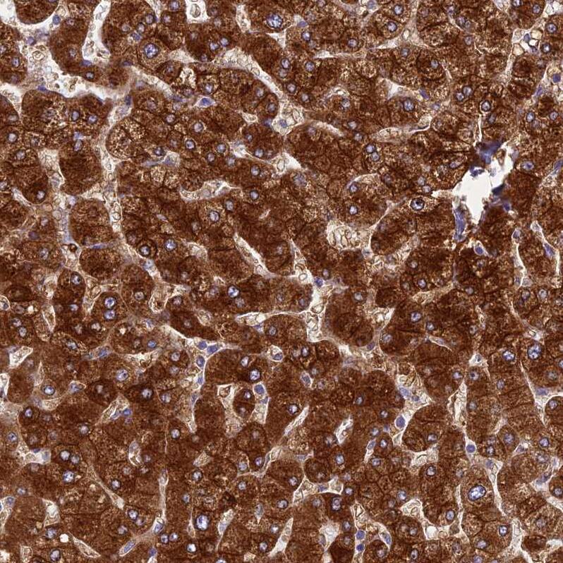 SPIRE1 Antibody - BSA Free Immunohistochemistry: SPIRE1 Antibody - BSA Free [NBP1-92439]
