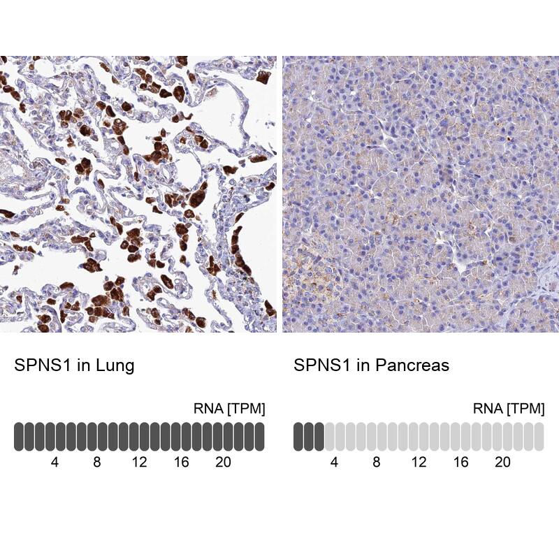 SPNS1 Antibody - BSA Free Immunohistochemistry: SPNS1 Antibody - BSA Free [NBP1-92440]