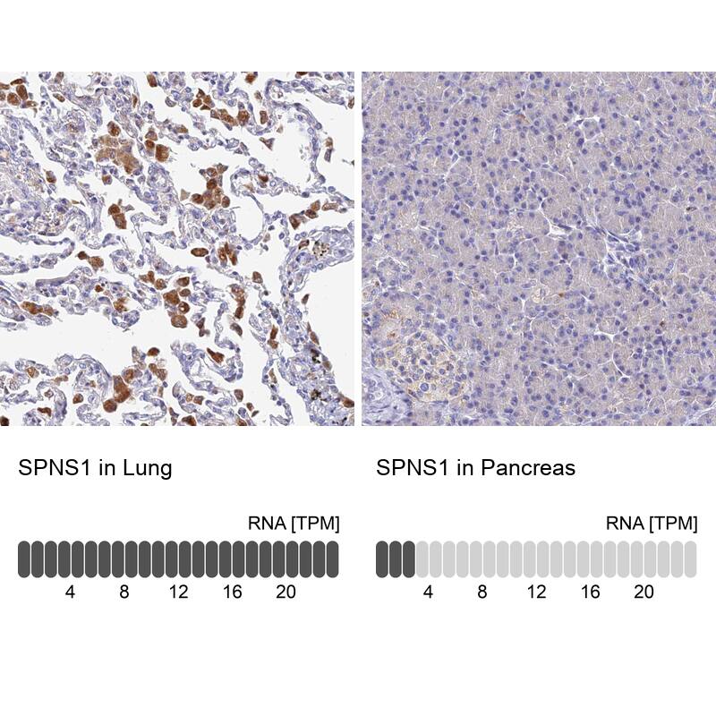 SPNS1 Antibody - BSA Free Immunohistochemistry: SPNS1 Antibody - BSA Free [NBP1-92441]