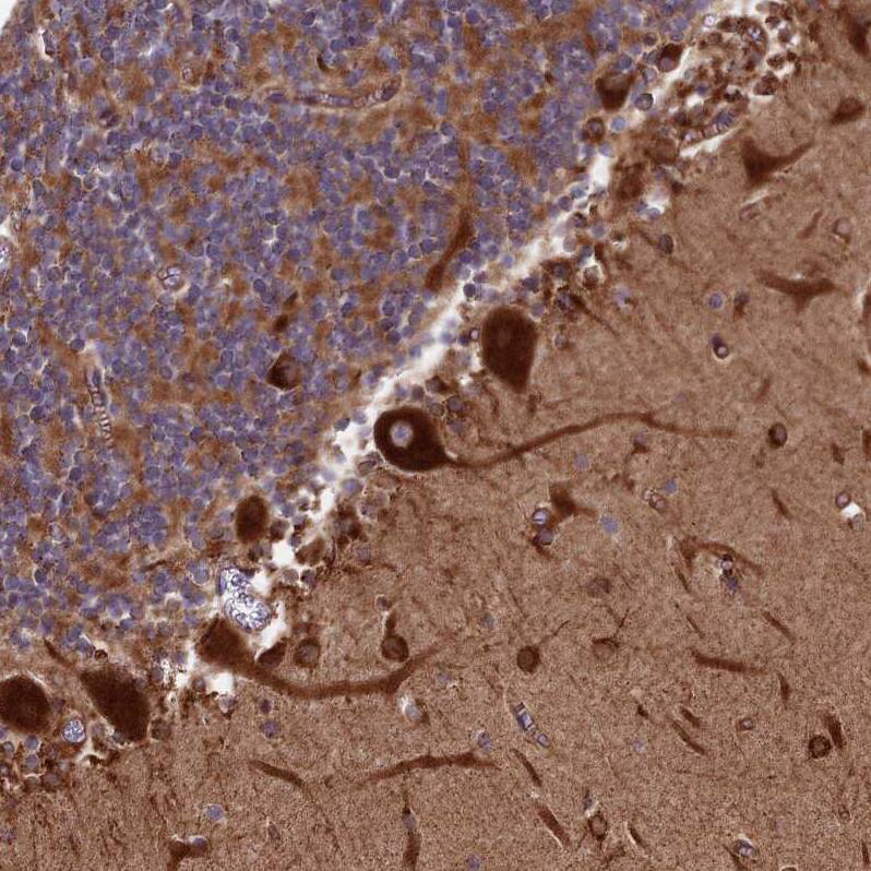 Testican 2/SPOCK2 Antibody - BSA Free Immunohistochemistry: Testican 2/SPOCK2 Antibody - BSA Free [NBP1-92442]