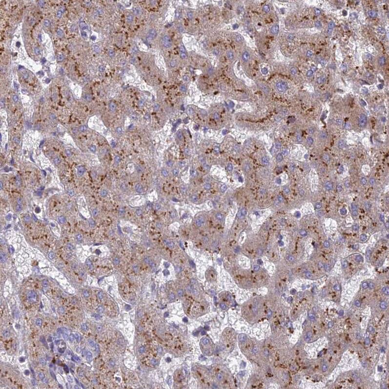 ST3GAL6 Antibody - BSA Free Immunohistochemistry: ST3GAL6 Antibody - BSA Free [NBP1-92446]